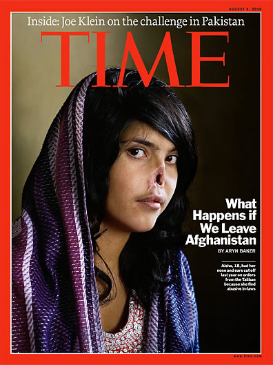 Maimed Afghan girl Bibi Aisha